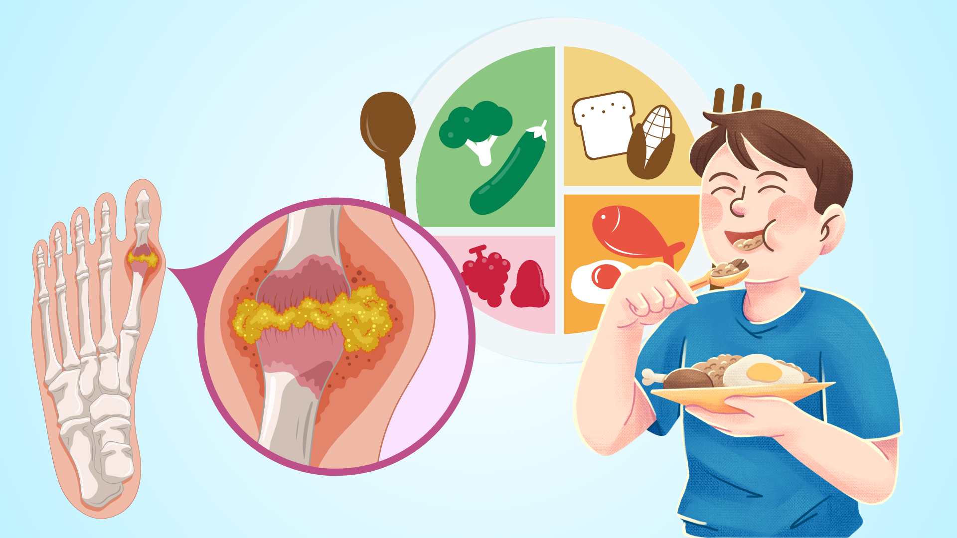 Foods to eat for gout patients in hot weather.