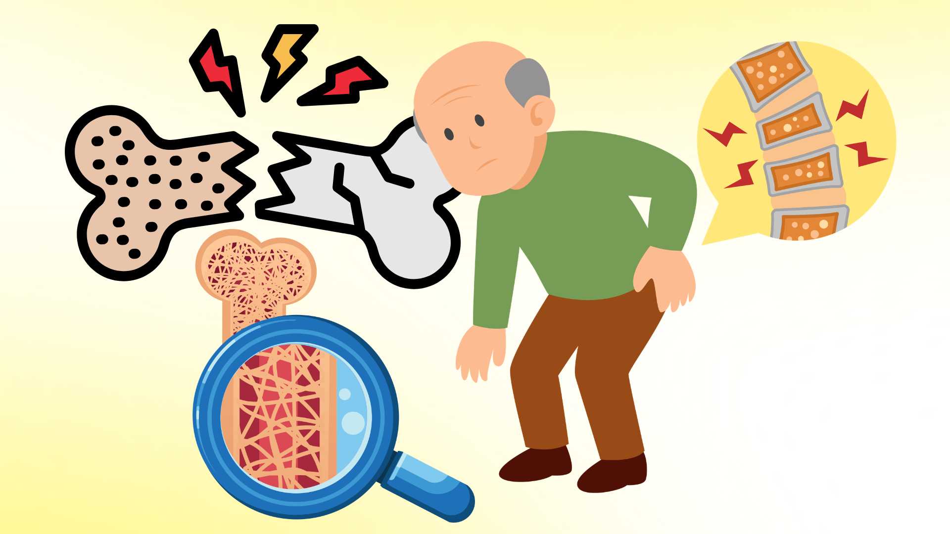 Elderly people need to do these things to reduce the risk of fractures due to osteoporosis