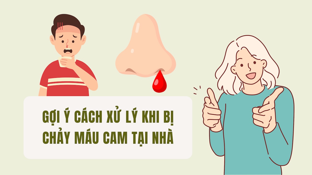 Suggested ways to handle nosebleeds at home