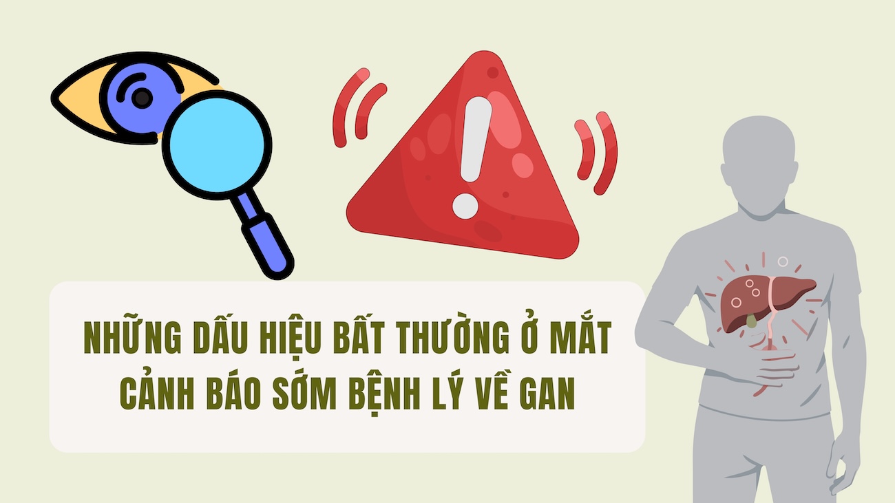 Abnormal signs in the eyes early warning of liver disease