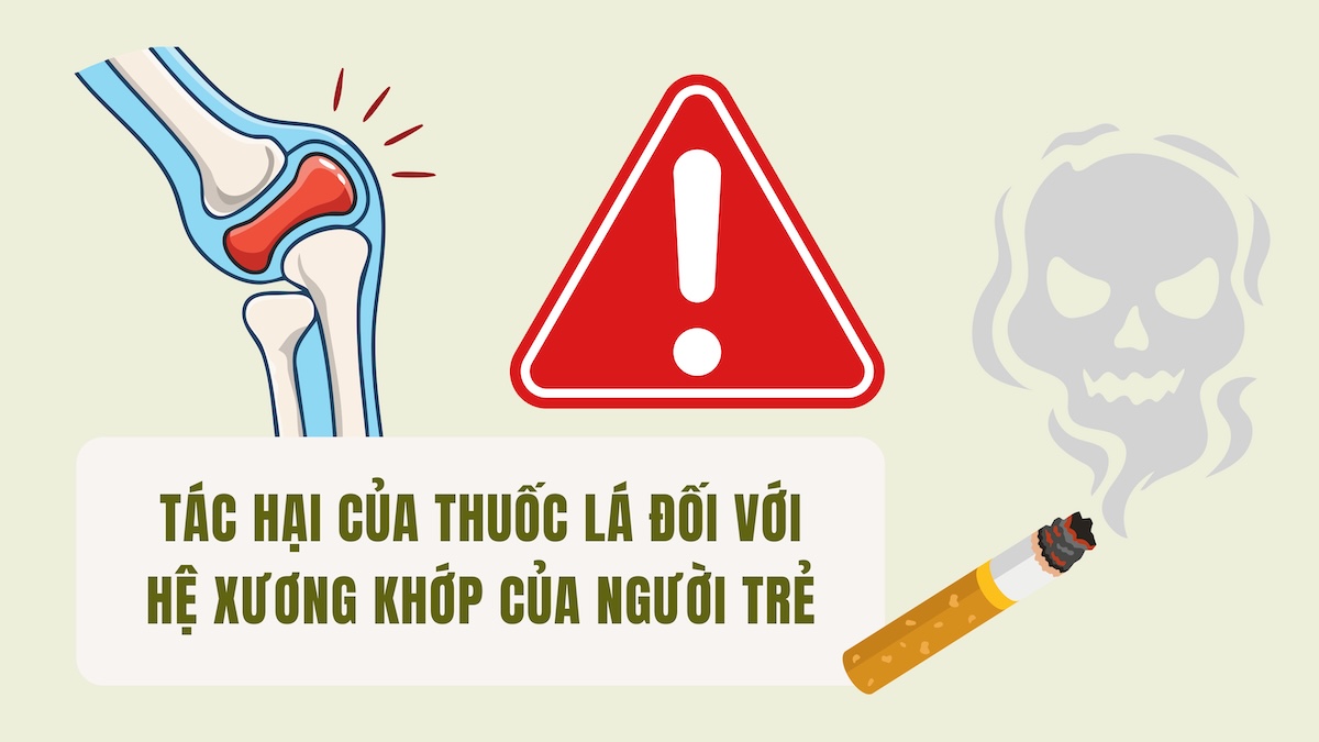L'effet du tabac sur le système musculo-squelettique des jeunes