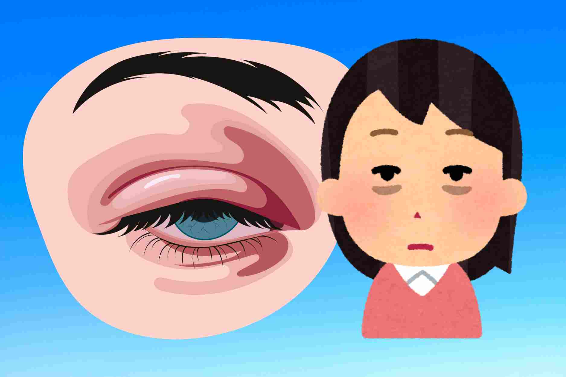 Raisons pour lesquelles les yeux sont sujets au gonflement et à l'apparition de cernes en été