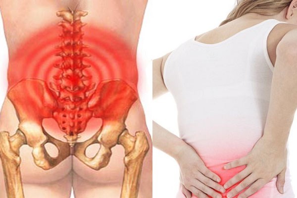Back pain is not only caused by sitting for a long time or incorrect posture, the cause may come from weak abdominal muscles causing prolonged pressure on the spine. Photo: Huong Son