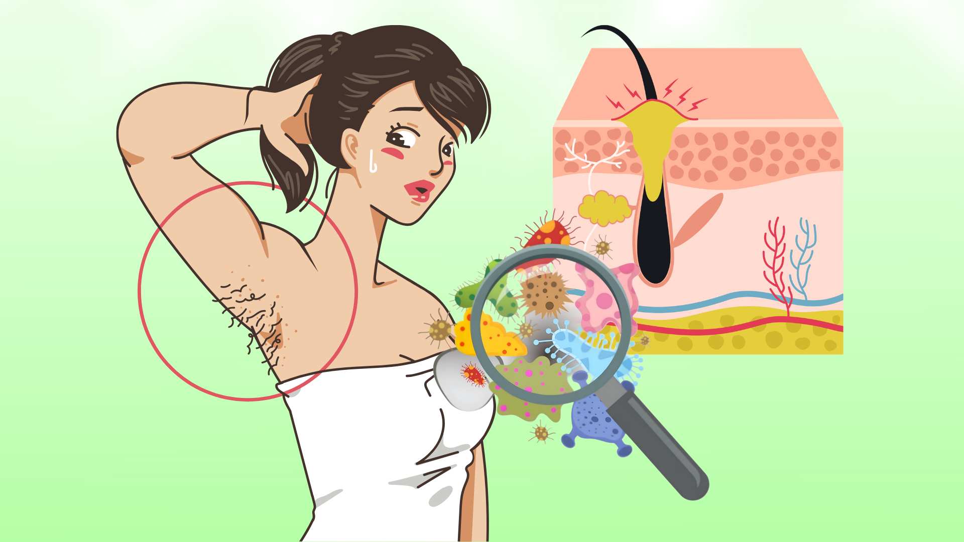 Top agents causing brachial folliculitis
