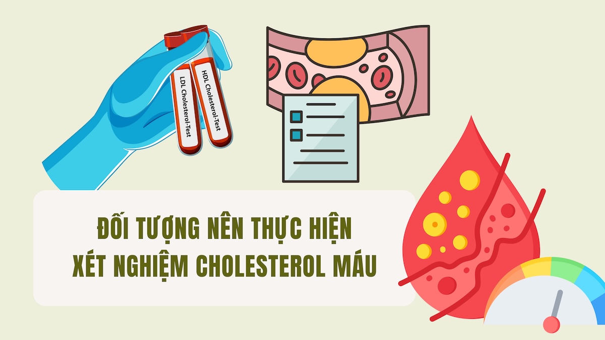 Les personnes devant subir un test de cholestérol sanguin