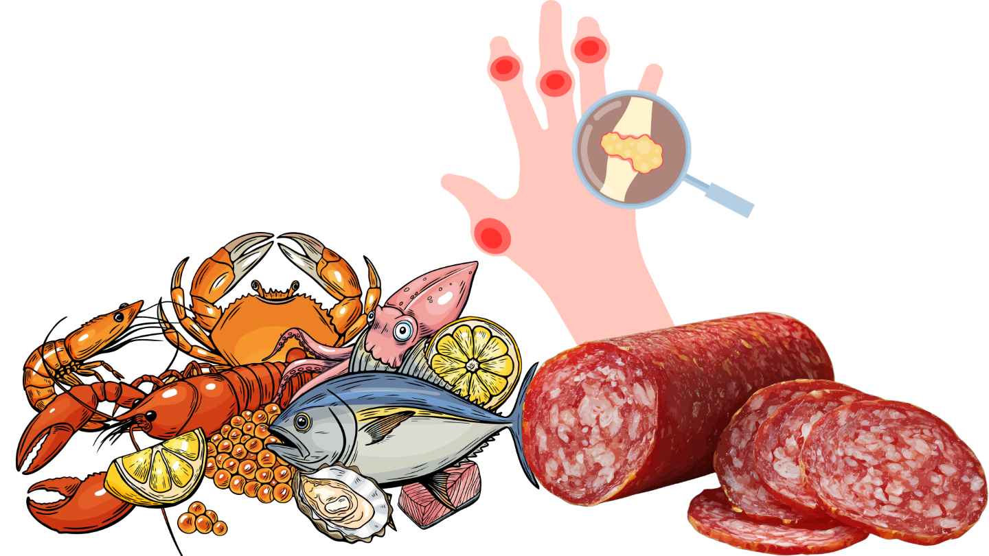 Foods that increase uric acid, increasing the risk of kidney disease. Graphics: Ha May