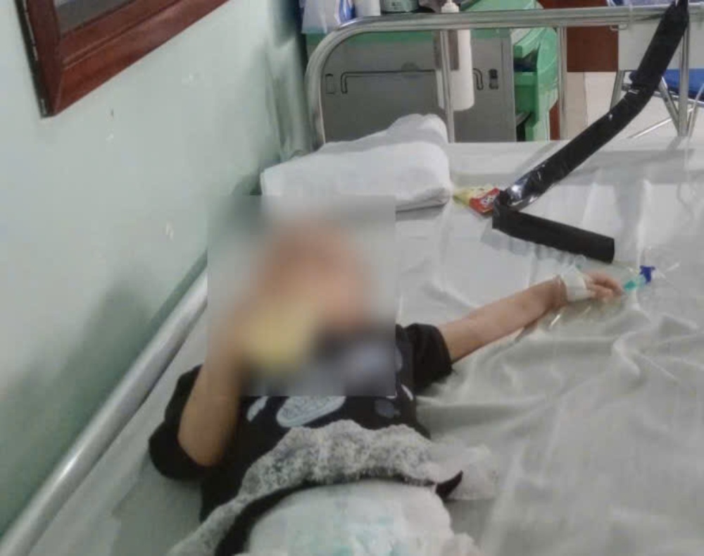 Baby Tran Dieu Tram was diagnosed with blood cancer when she was too young... Photo: Family provided