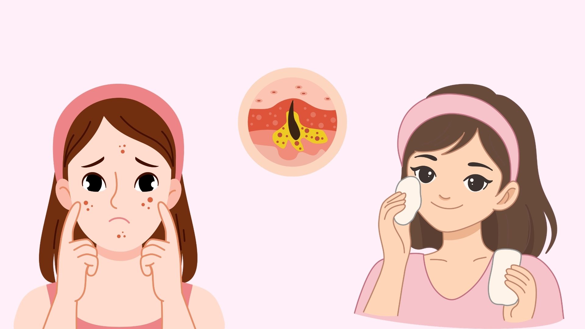 To help make pores smaller and smoother, you can refer to the methods below. Graphics: Minh Chau