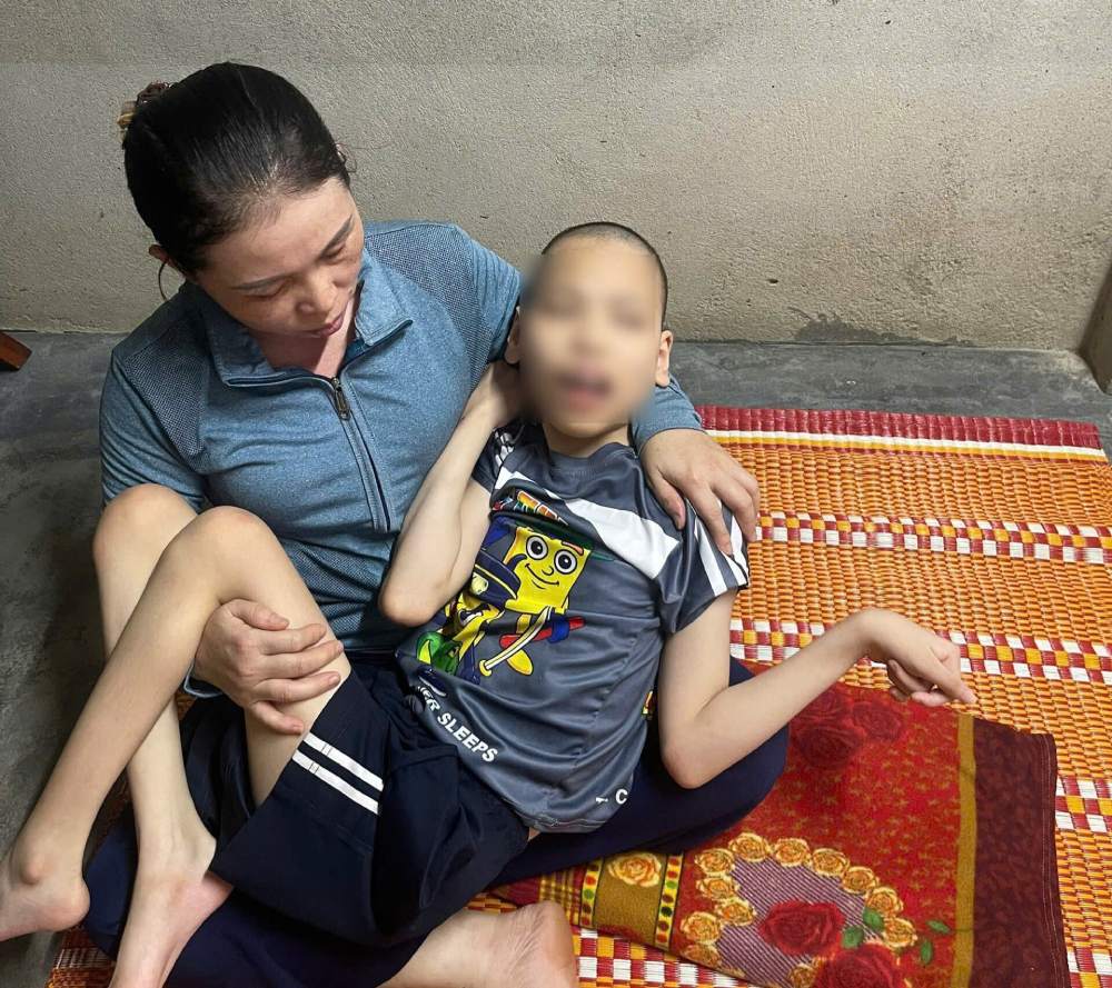 Ms. Le Thi Hien's family is exhausted after 14 years of worrying about their brain-damaged son. Photo: Family provided