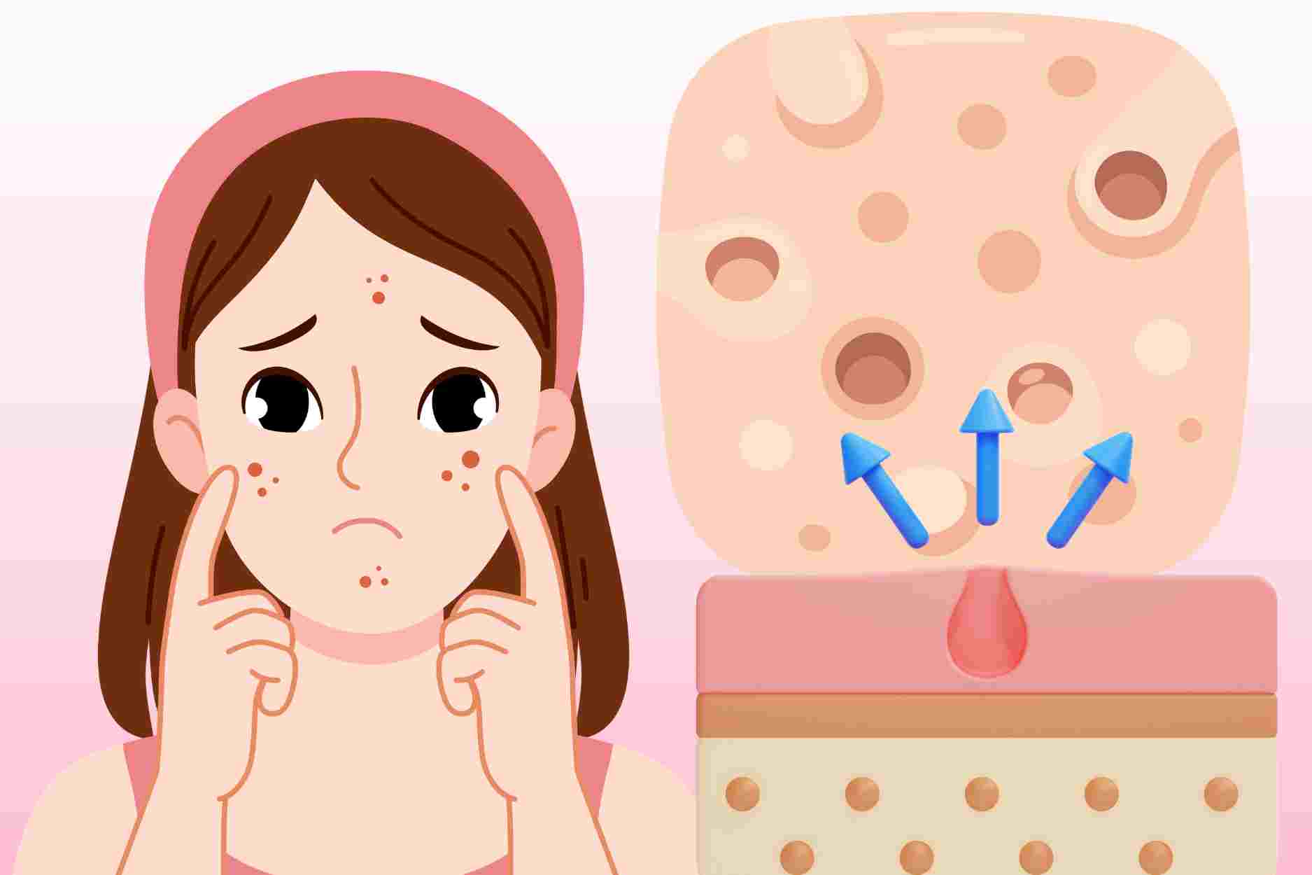 Tell you 2 important ways to effectively shrink pores