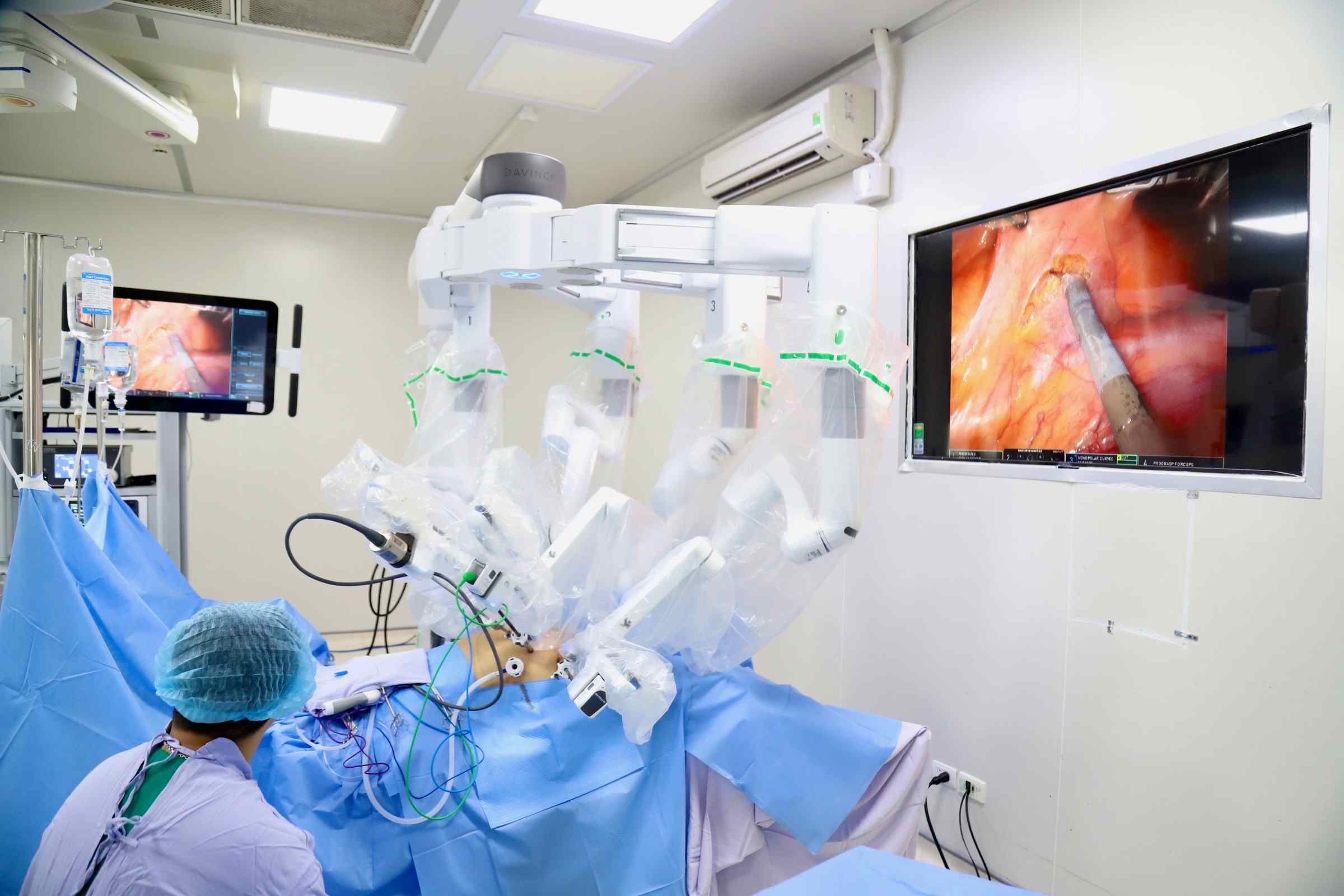 From July 1st, health insurance pays for technical services up to nearly 114 million VND/time. Illustrative photo: Tran Ha