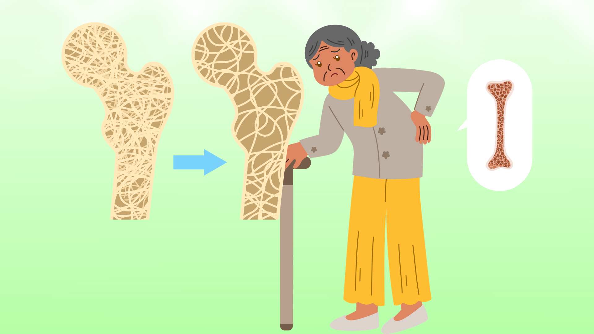 Habits to help improve postmenopausal osteoporosis