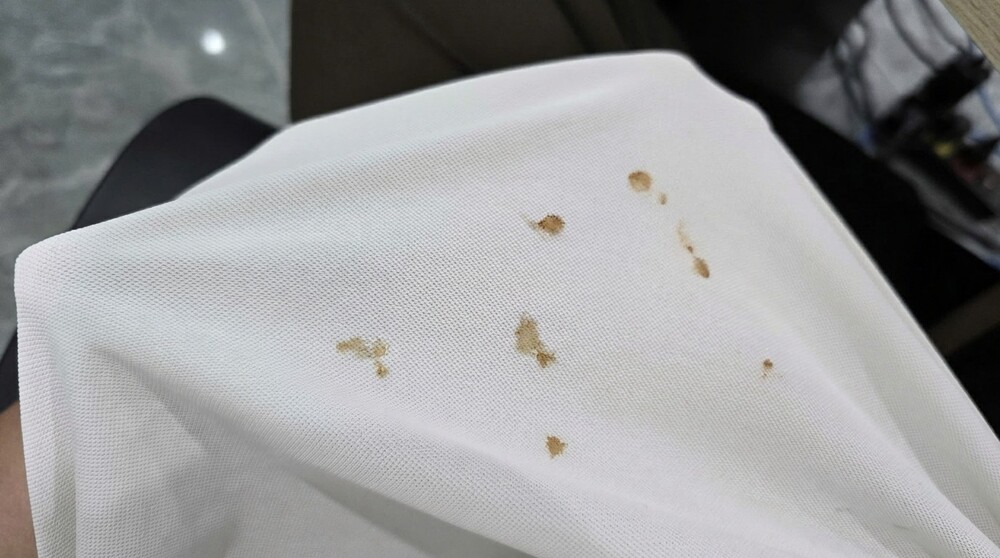 Applying some basic treatments quickly will help effectively remove coffee stains. Photo: Tuan Dat