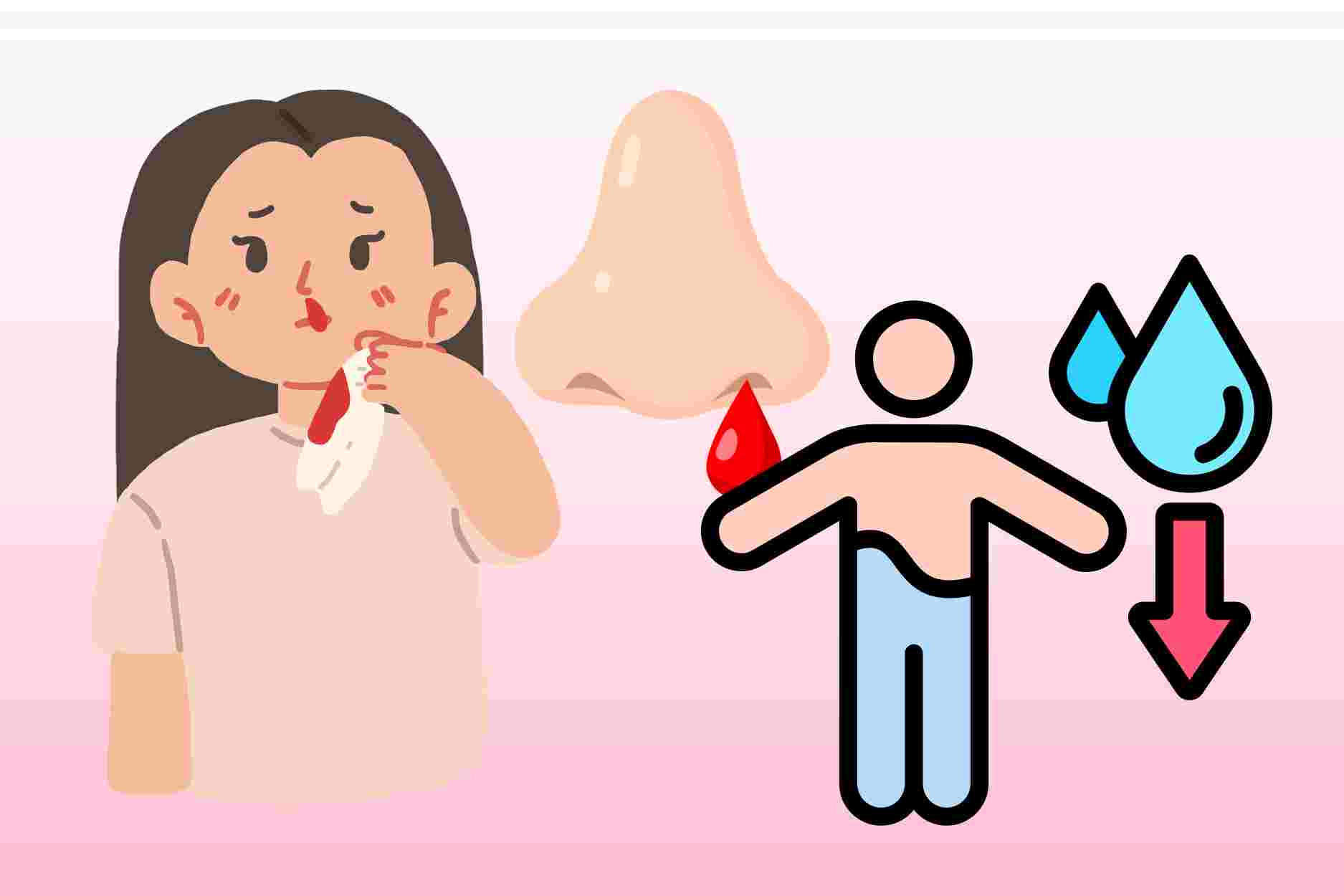 Dehydration can increase the risk of nosebleeds