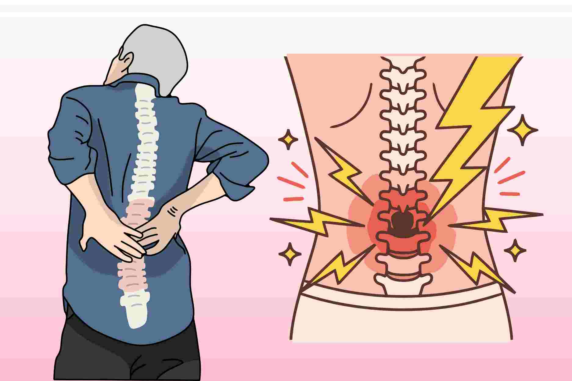 Causes of back pain