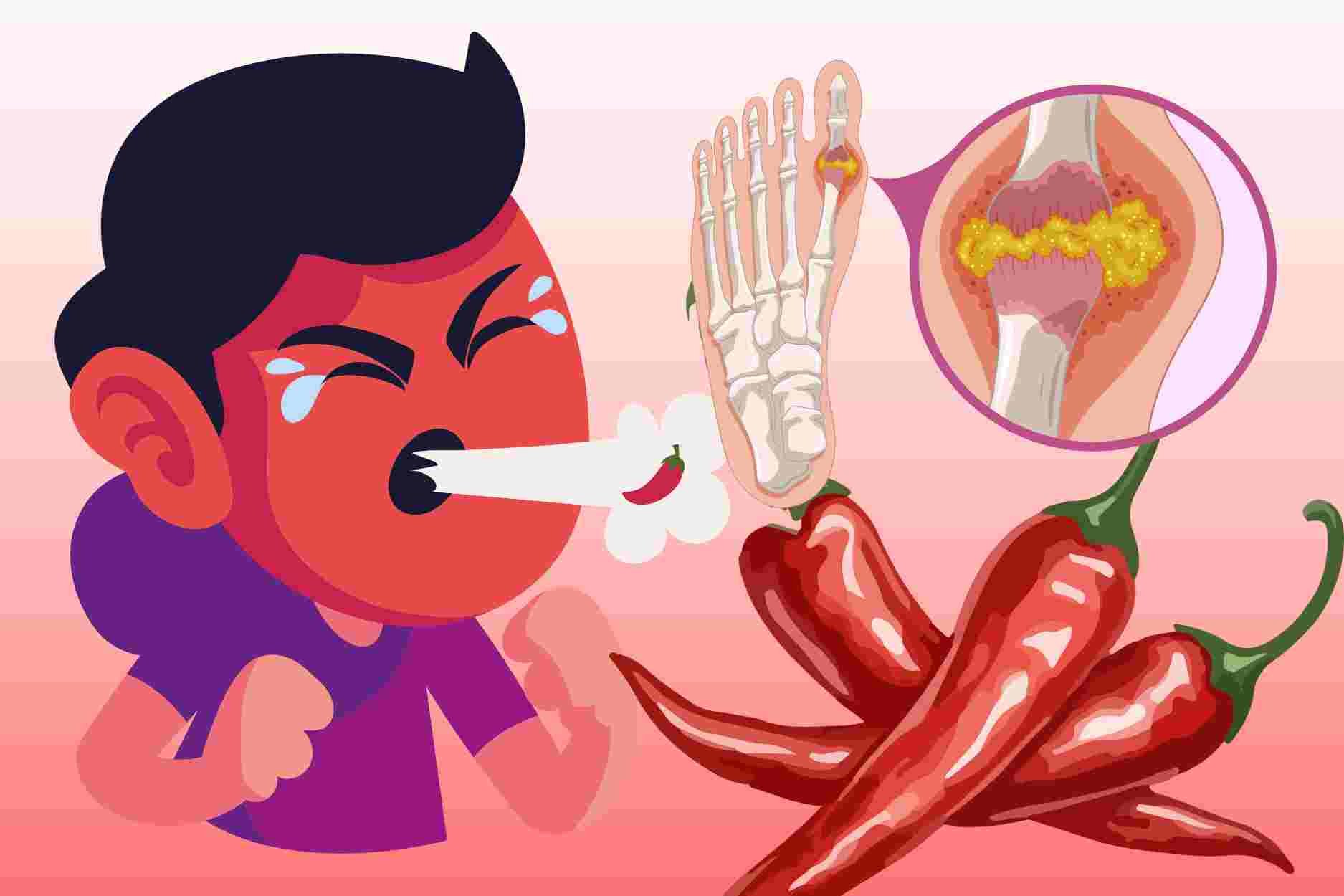 The truth about the effects of chili peppers on gout