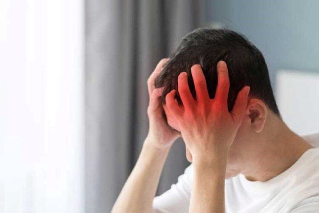 Why does the body send signals before a migraine. Photo: Thao Nhung