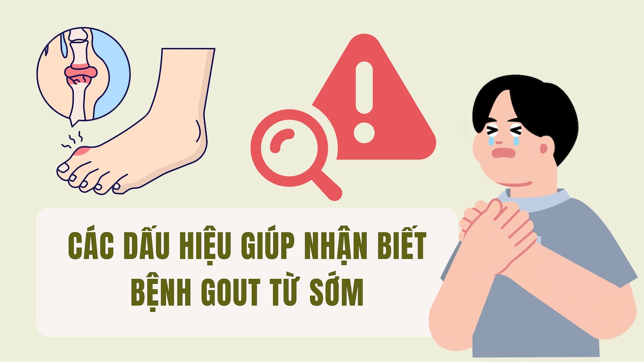 Signs to help recognize gout early