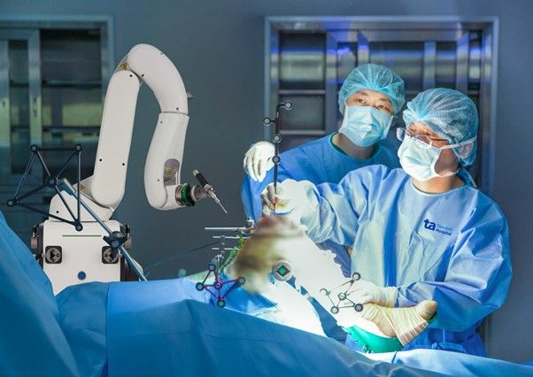 Bác sĩ sử dụng robot CUVIS-Joint phục dựng cấu trúc khớp 3D và thay khớp thành công cho bà Ngọc. Ảnh: Bệnh viện Đa khoa Tâm Anh