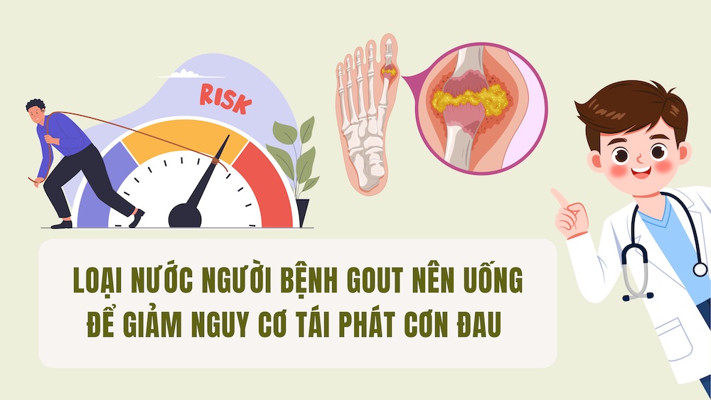 Types of drinks gout patients should drink to reduce the risk of pain recurrence