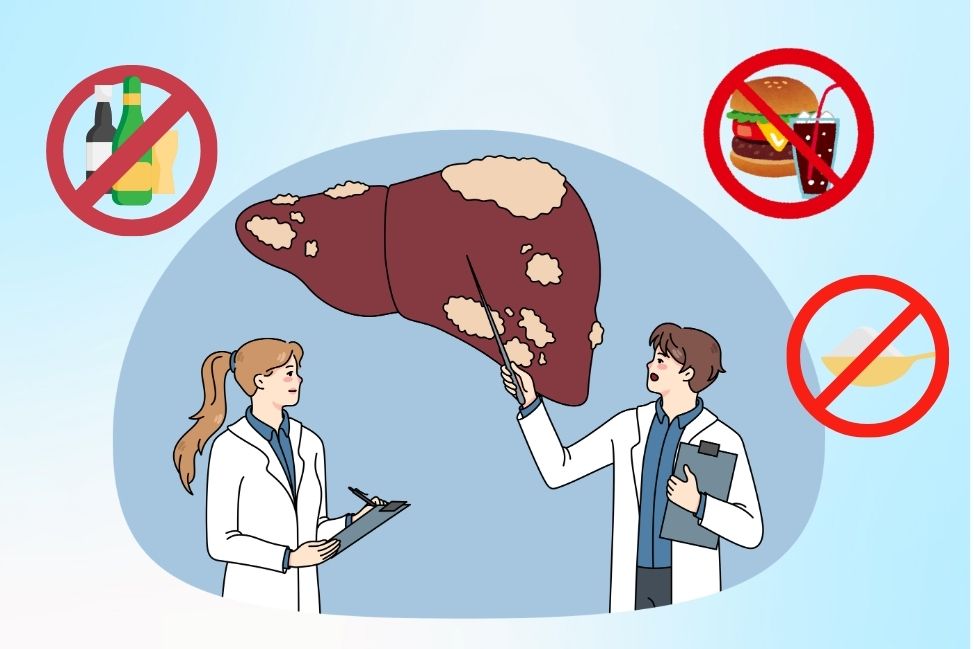 4 foods to limit to reduce the risk of fatty liver