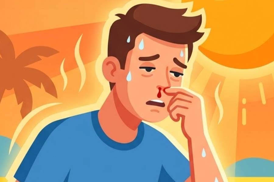 Summer heat can cause nosebleeds in healthy people. Graphics: Thien Nhan