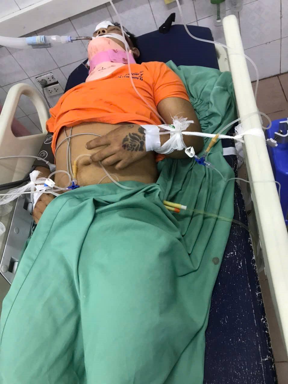 Em Bùi Tiến Dương bị chấn thương sọ não sau tai nạn giao thông. Ảnh: Gia đình cung cấp.