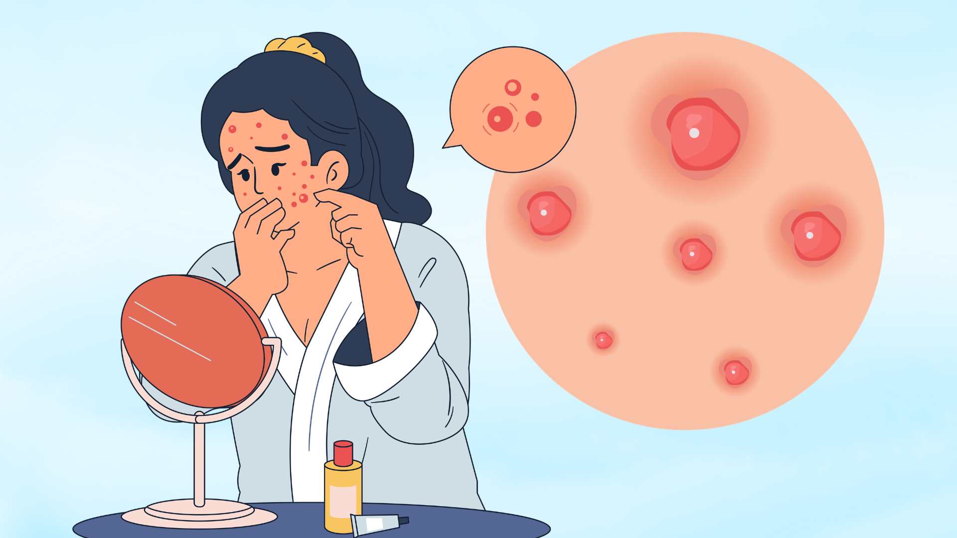Tell you skin care secrets for people prone to acne