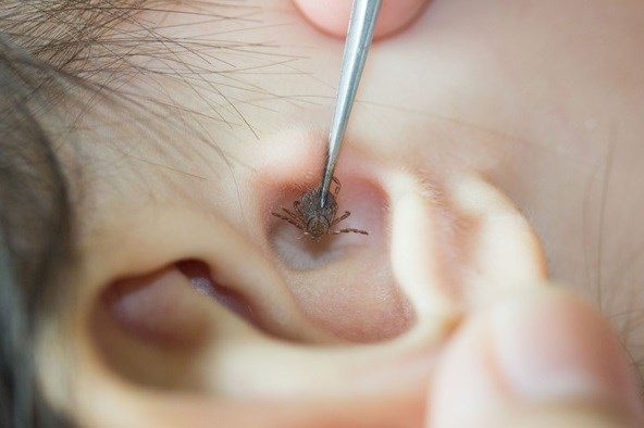 2-year-old girl parasitized by fleas right in her ear. Photo: BVCC