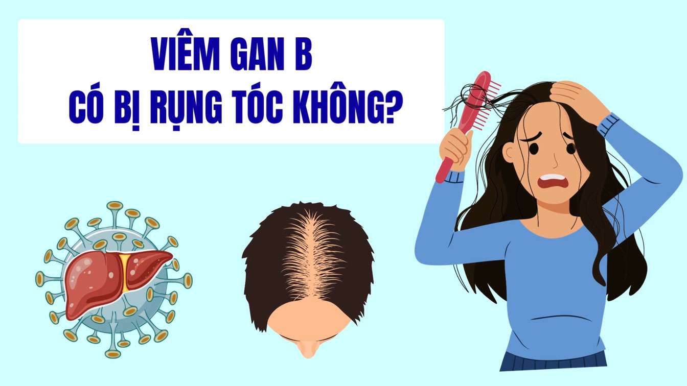 ¿La hepatitis B provoca la caída del cabello?