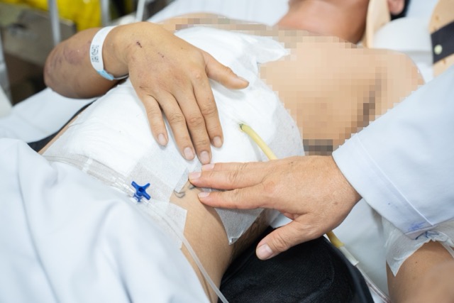 Patients in the Phan Thiet - Dau Giay expressway accident are being treated stably by doctors. Photo: BVCC