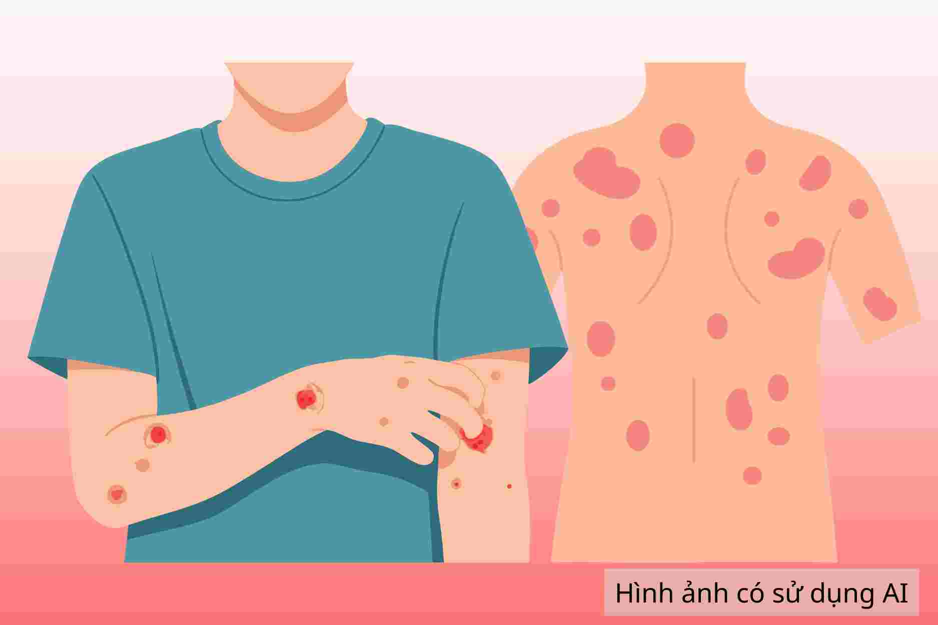 Tell you the signs of body skin fungus for timely treatment