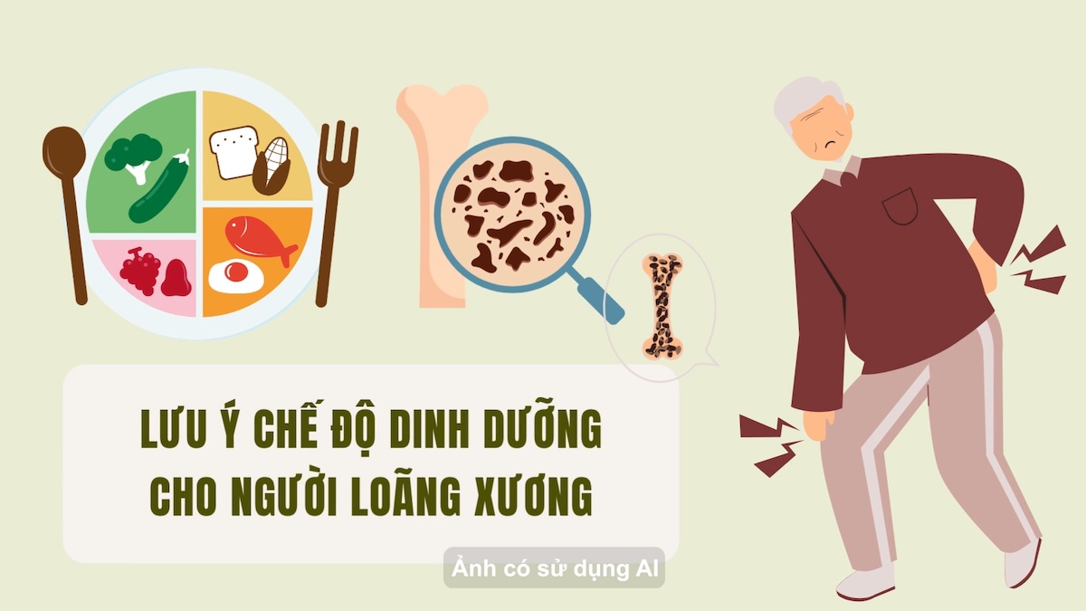 Notez le régime alimentaire pour les personnes atteintes d'ostéoporose