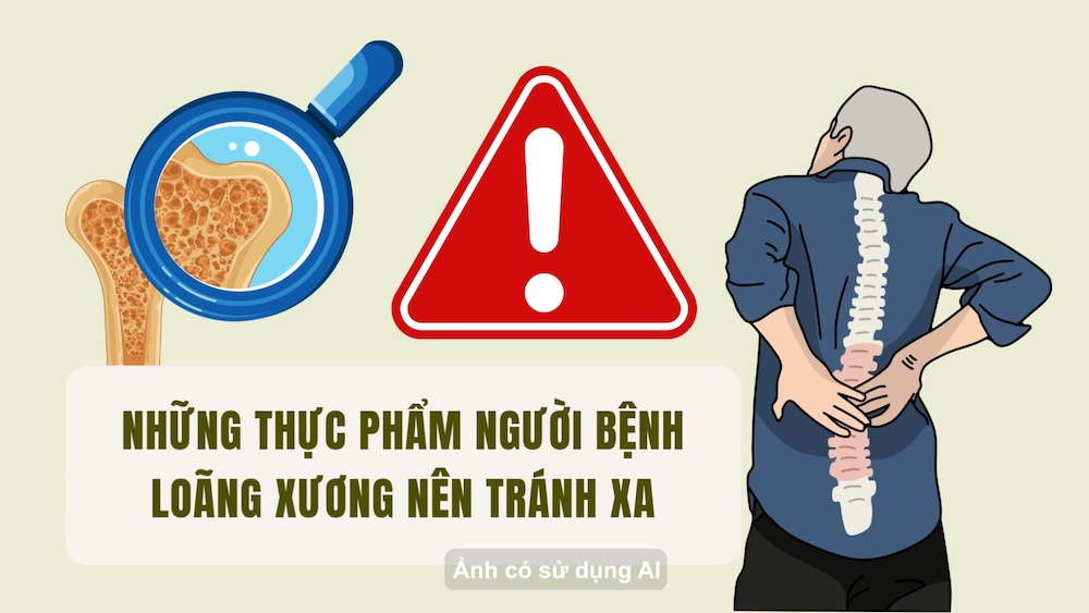 골다공증 환자가 피해야 할 음식