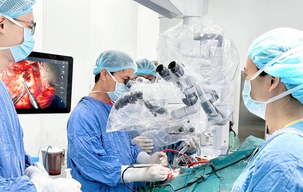 Dr. Nguyen Thanh Xuan - Deputy Head of Department of Neurosurgery 1 - performs emergency surgery on the first night of duty at Viet Duc Friendship Hospital, Ninh Binh facility. Photo: Hospital