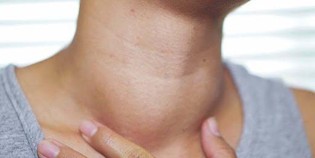 90% of thyroid tumors are benign. Image source: Thu Duc General Hospital HCMC