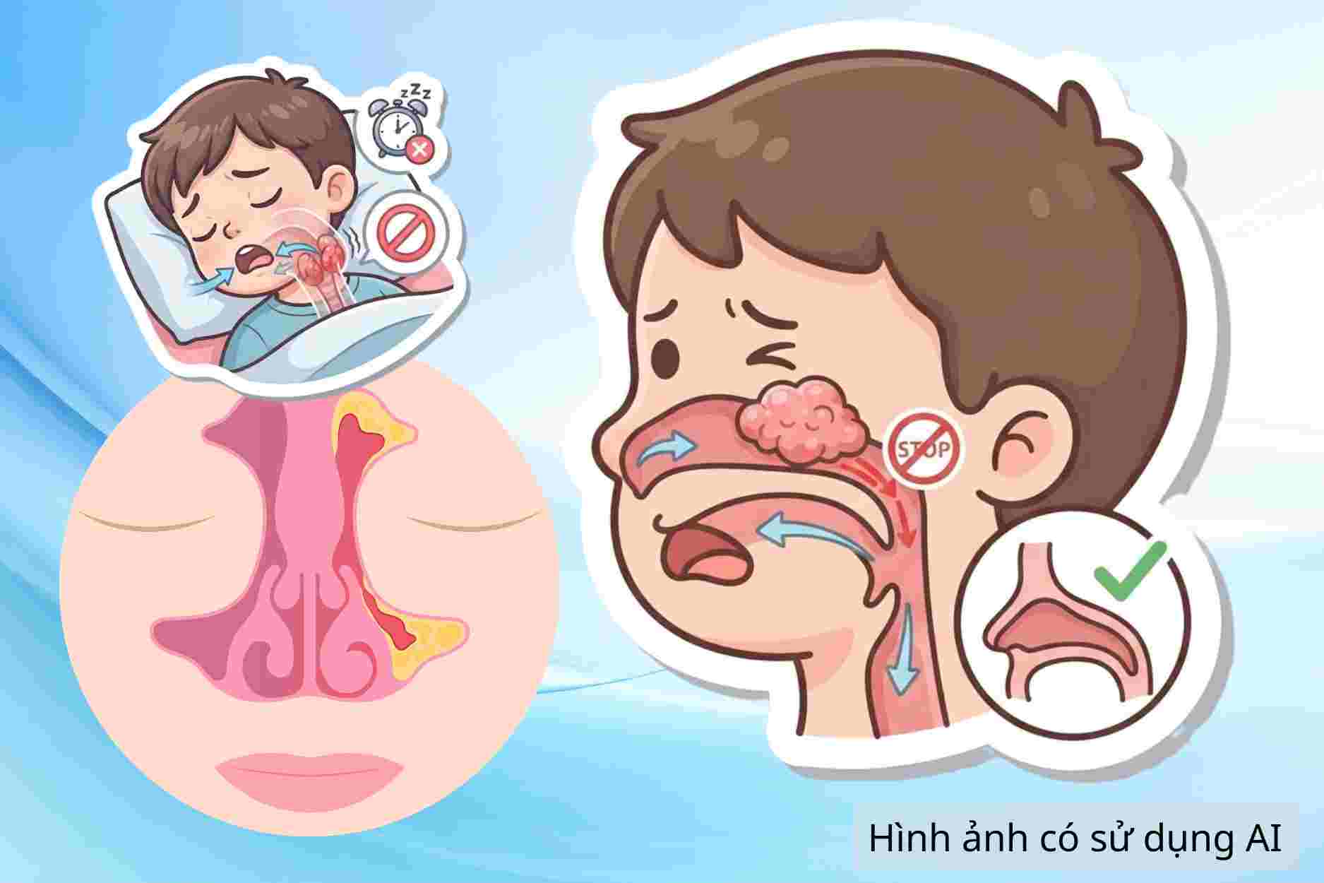 5 reasons why children have to breathe through their mouths