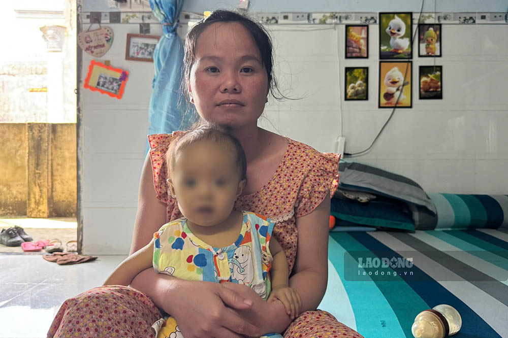Baby Than Gia Thinh in Tay Ninh suffers from congenital biliary tract atrophy leading to cirrhosis, waiting for liver transplants to have a chance to be saved. Photo: Thanh Vu