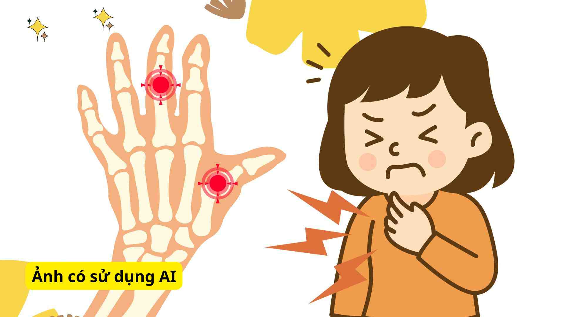 High uric acid increases the risk of urate crystal formation in joints, causing inflammation and pain due to gout. Graphic photo: Huong Son/ Photo using AI