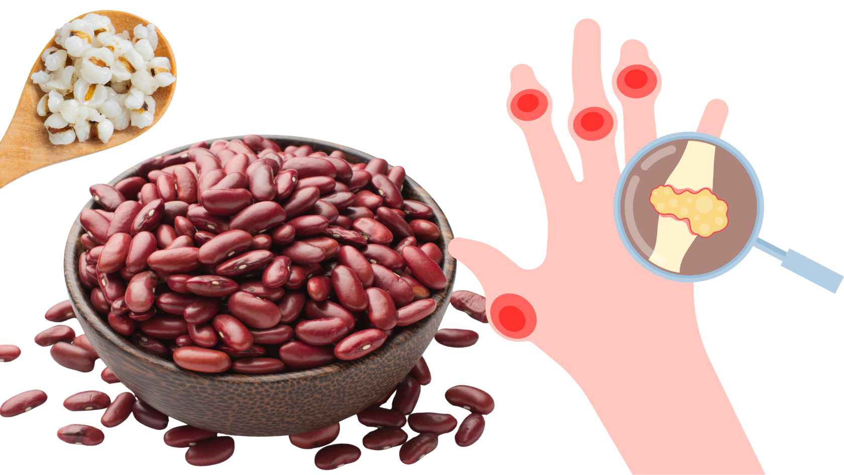 People with high uric acid should supplement with some porridge. Graphics: Ha May/Source Canva