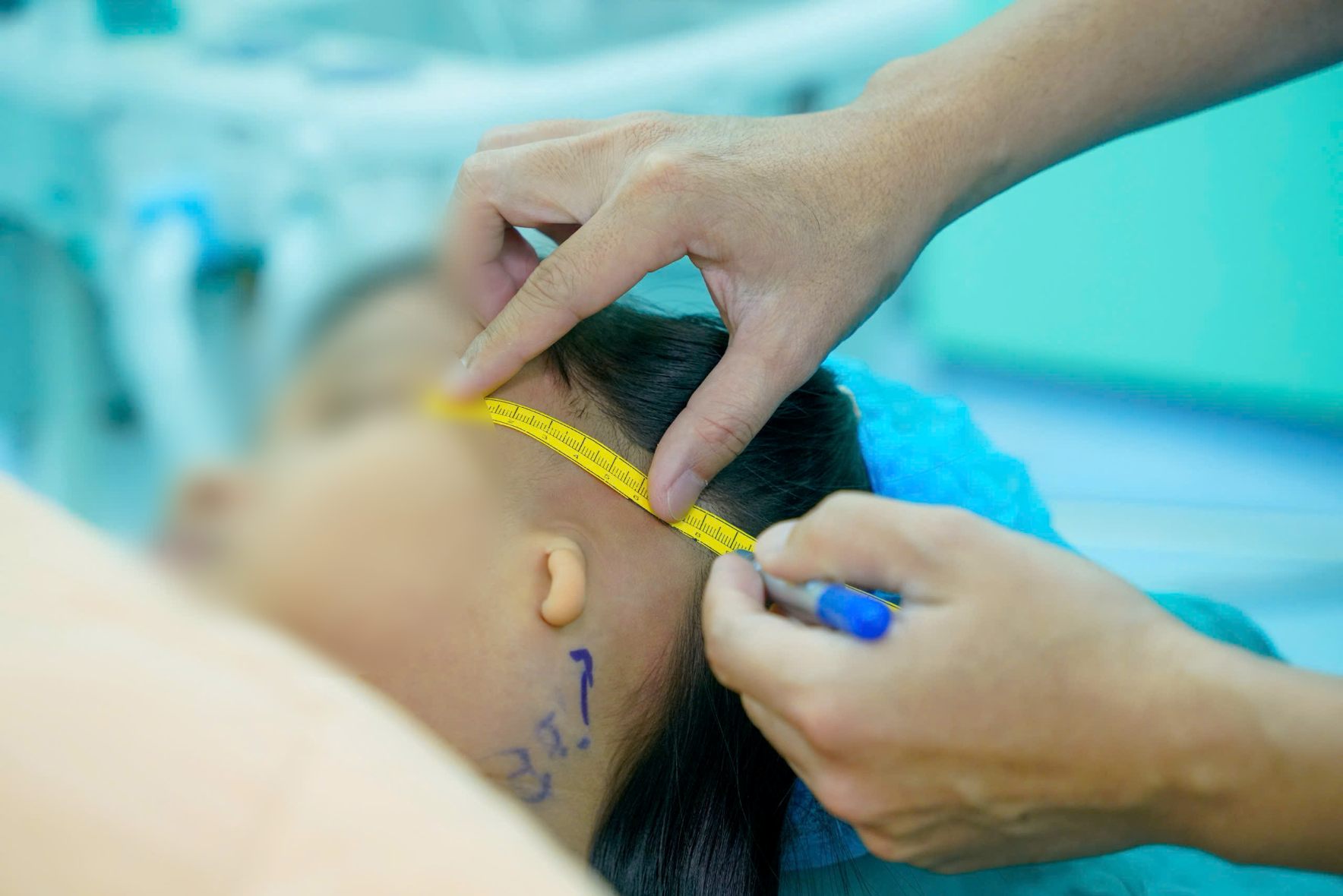 Patients are measured and assessed the structure of the ear area before surgery. Photo: Provided by Ho Chi Minh City University Medical Center Hospital