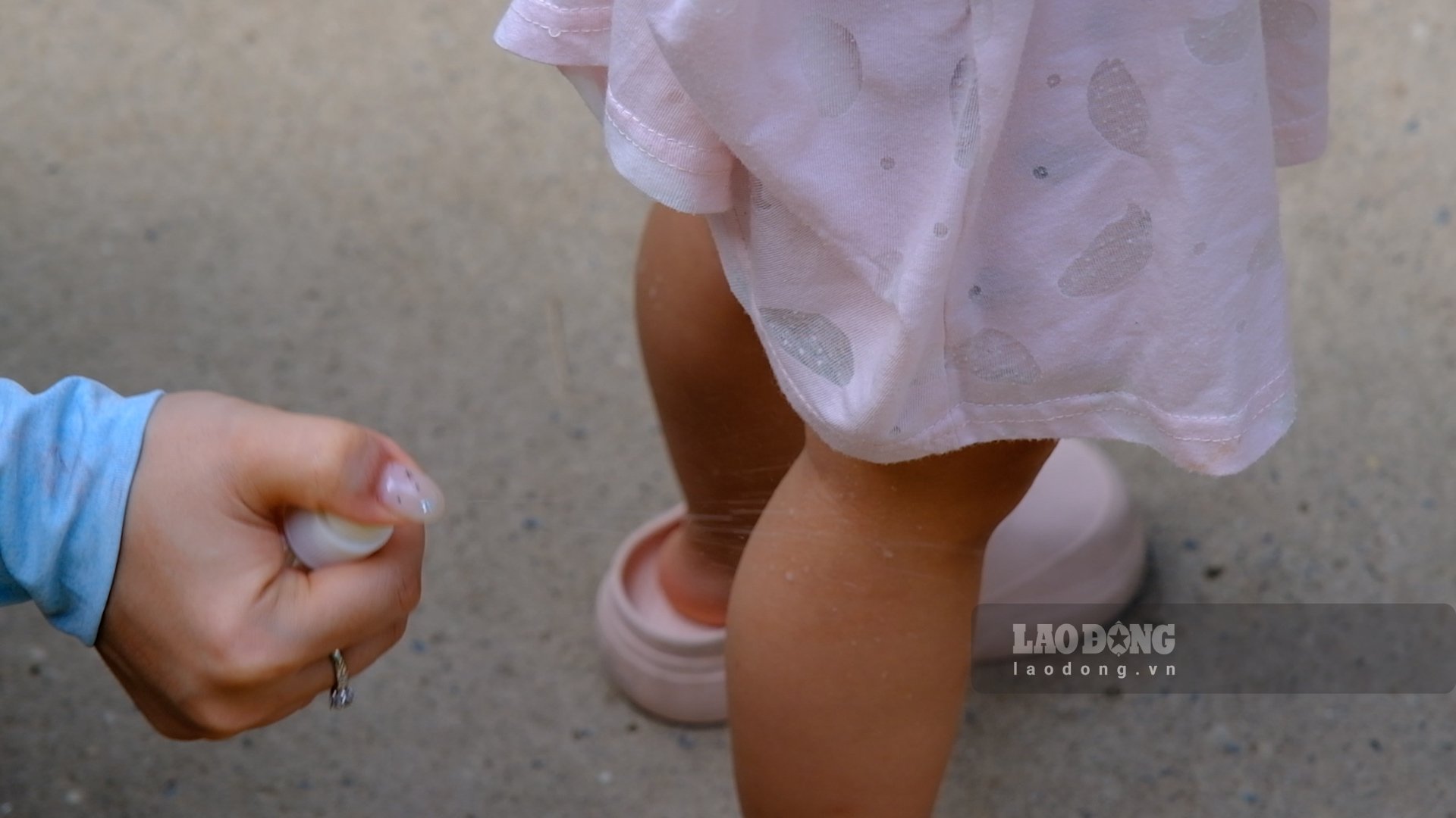Adenovirus increases, doctors warn of infection routes