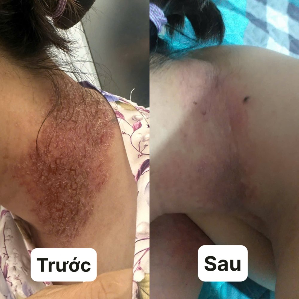 Patients with skin diseases before and after treatment. Photo: BVCC