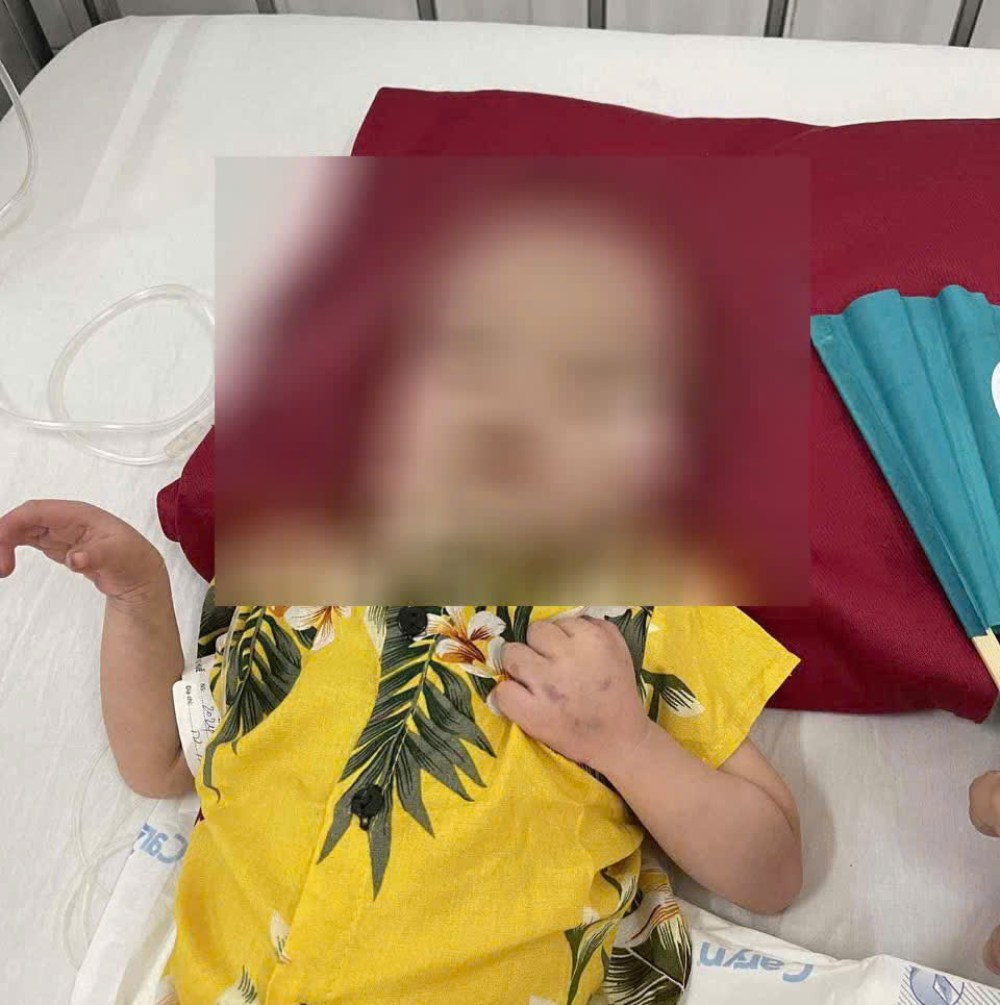 先天性心疾患と一連の重篤な合併症により、男の子ティエン・ダットの幼少期は、長期にわたる救急治療と治療にのみ関連付けられていました... 写真:家族提供