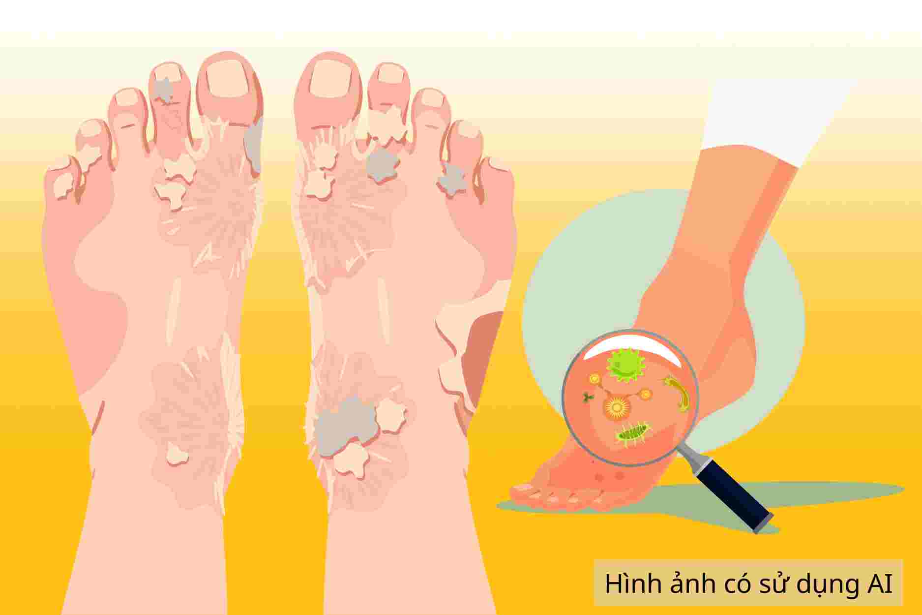 How to prevent foot fungus when you have to wear shoes regularly in the summer