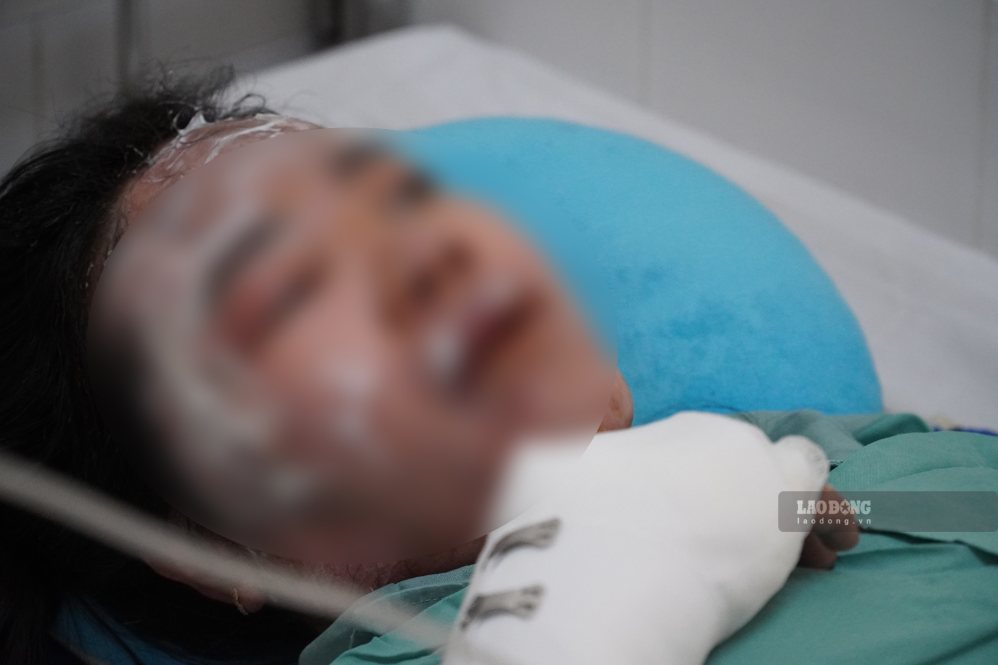 Chị Bích vẫn còn ám ảnh về vụ cháy. Ảnh: HAC