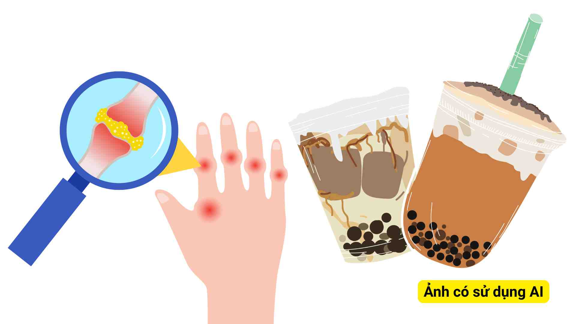 L'habitude de boire beaucoup de thé au lait rend les jeunes sujets à un taux d'acide urique élevé. Photo graphique: Hương Sơn/ Photo utilisant l'IA