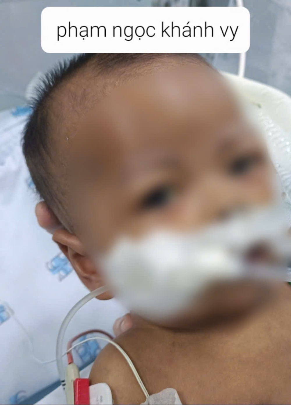 Bé Khánh Vy bị suy gan mạn tính giai đoạn cuối, tổn thương thận và nhiễm trùng máu nặng. Ảnh: Gia đình cung cấp