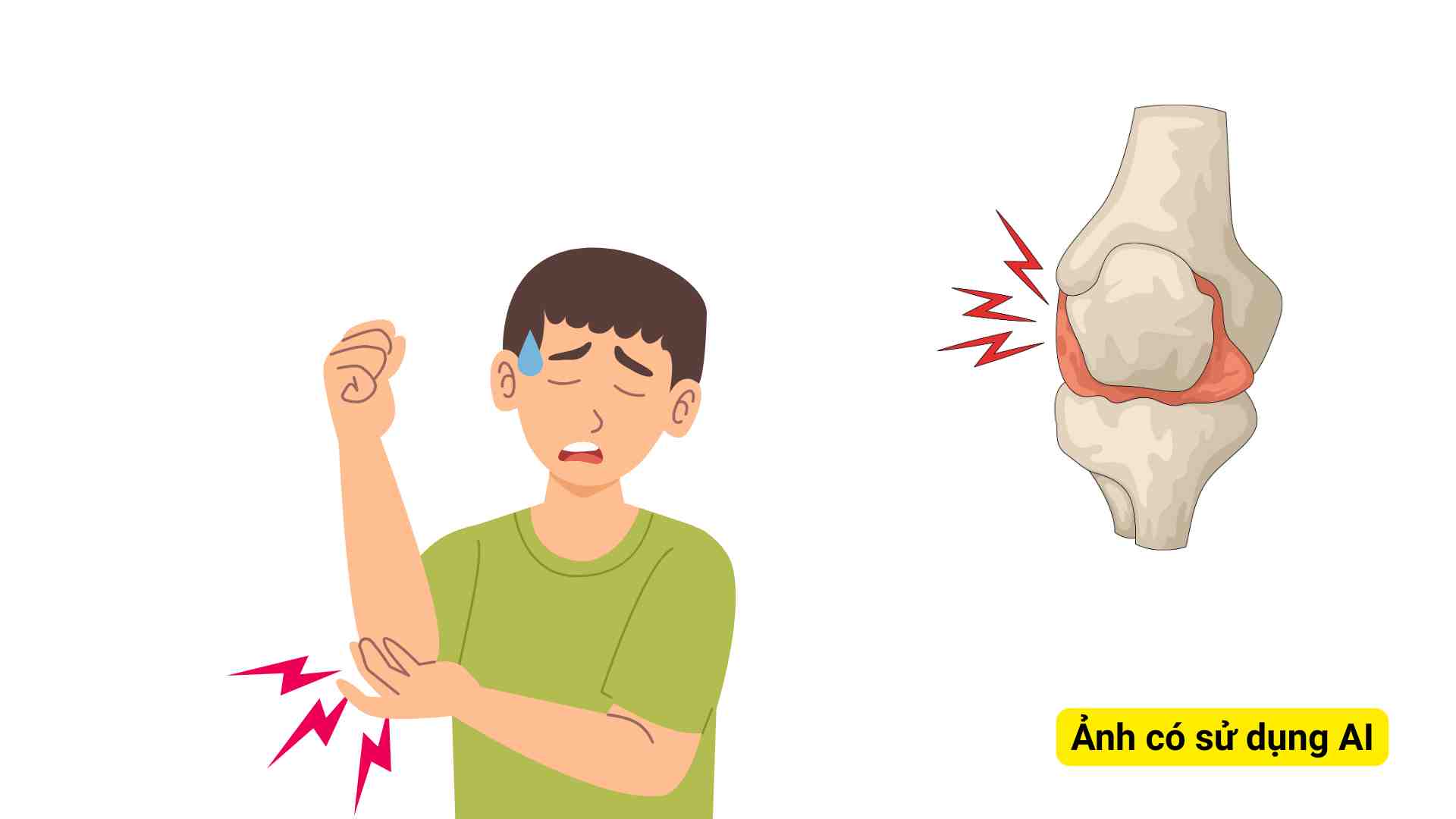 Back stiffness or less flexible joints after waking up. Graphic photo: Huong Son/ Photos using AI