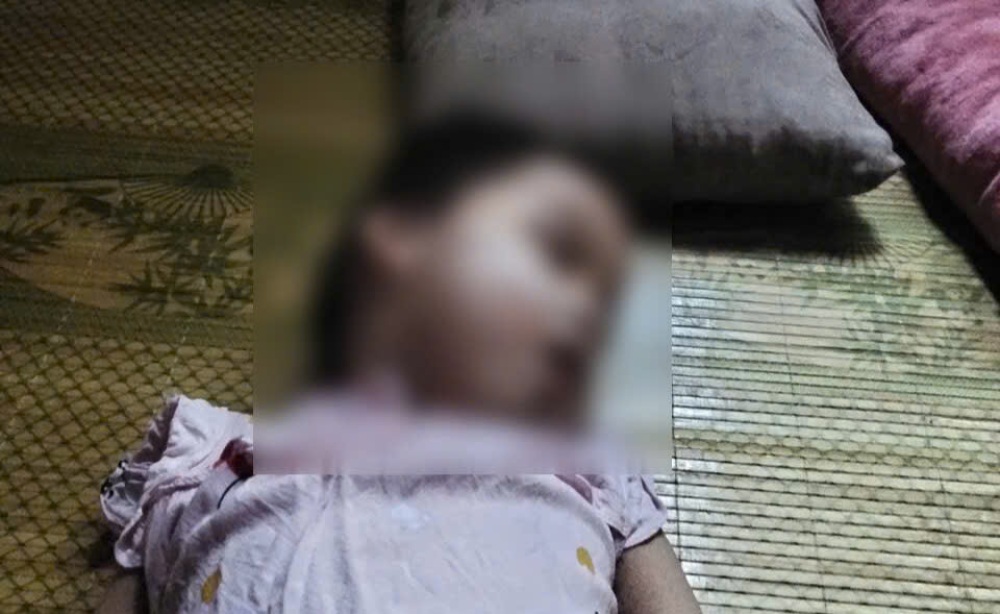Baby To Nguyen Hong Nhi (born in 2021) suffers from epilepsy and cerebral palsy, causing the young mother to face many difficulties. Photo: Family provided